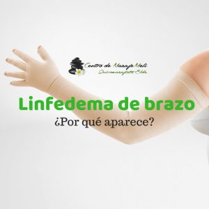 Linfedema de brazo